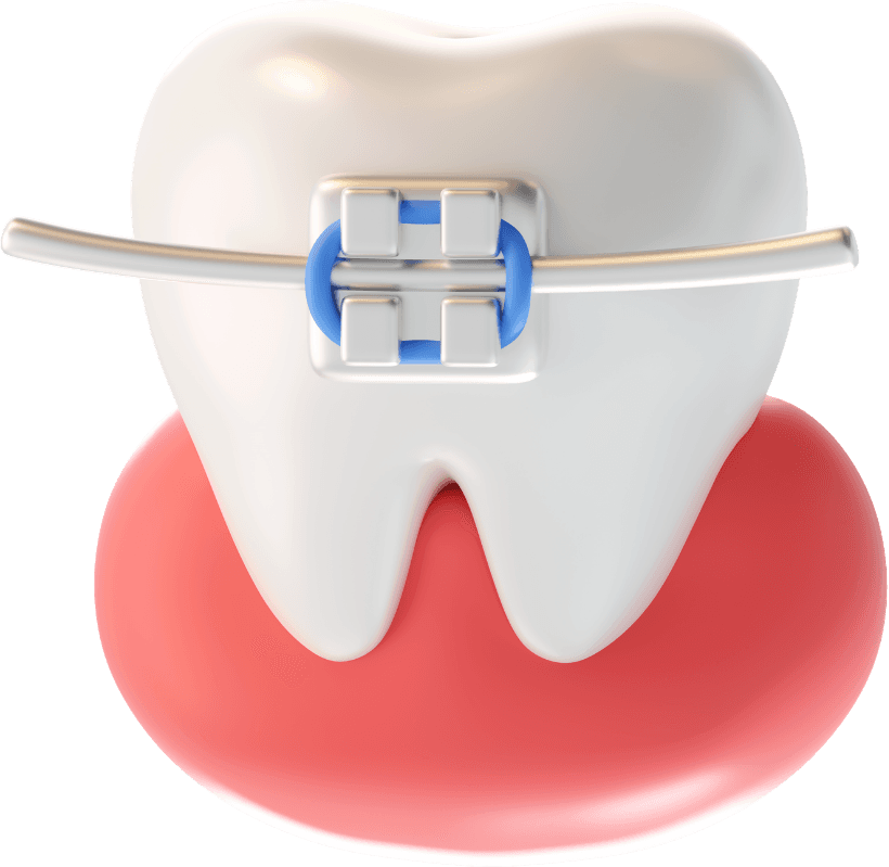 Braces & Aligners